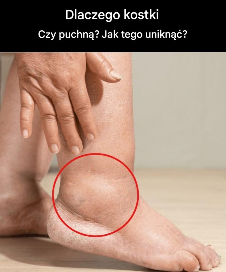 Opuchni_te_nogi__jakie_s__objawy_i_sposoby_rozwi_zania_problemu_-1