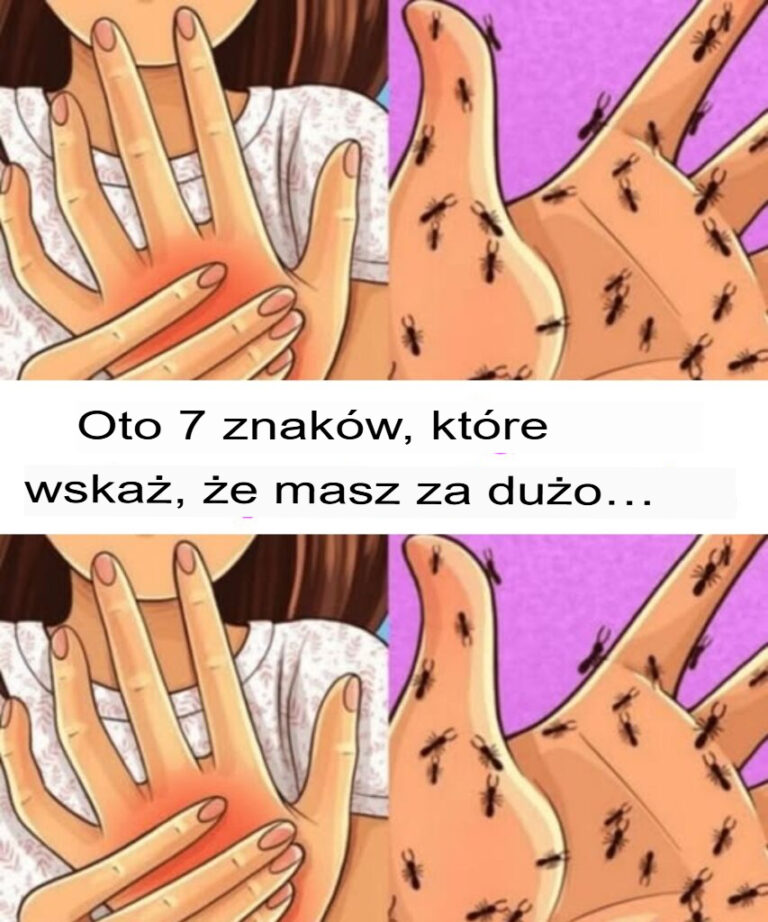 Oto_7_oznak__kt_re_wskazuj____e_masz_za_du_o_