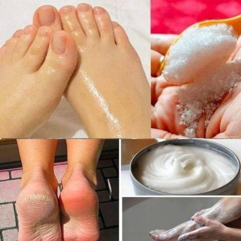 Oto_jak_wykona__pedicure_w_domu_przy_u_yciu_sody_oczyszczonej Oto_jak_wykona__pedicure_w_domu_przy_u_yciu_sody_oczyszczonej