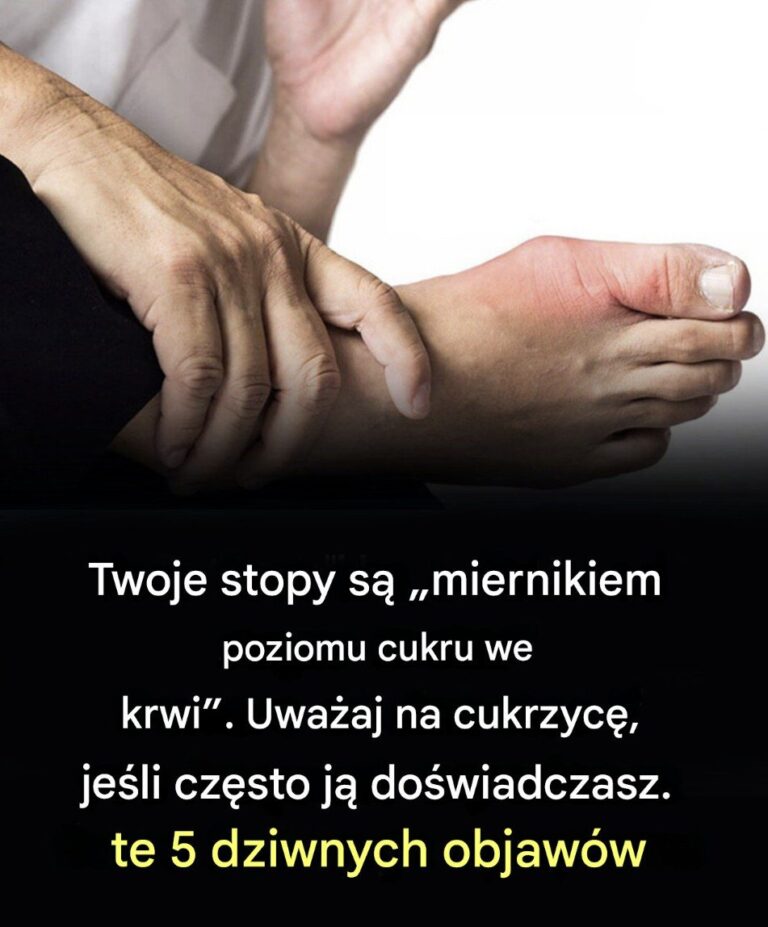 Oto_pi___nietypowych_objaw_w_st_p_Twoje_stopy_to__wska_nik_poziomu_cukru_we_krwi______5_dziwnych_objaw_w__kt_re_mog__sygnalizowa__cukrzyc_