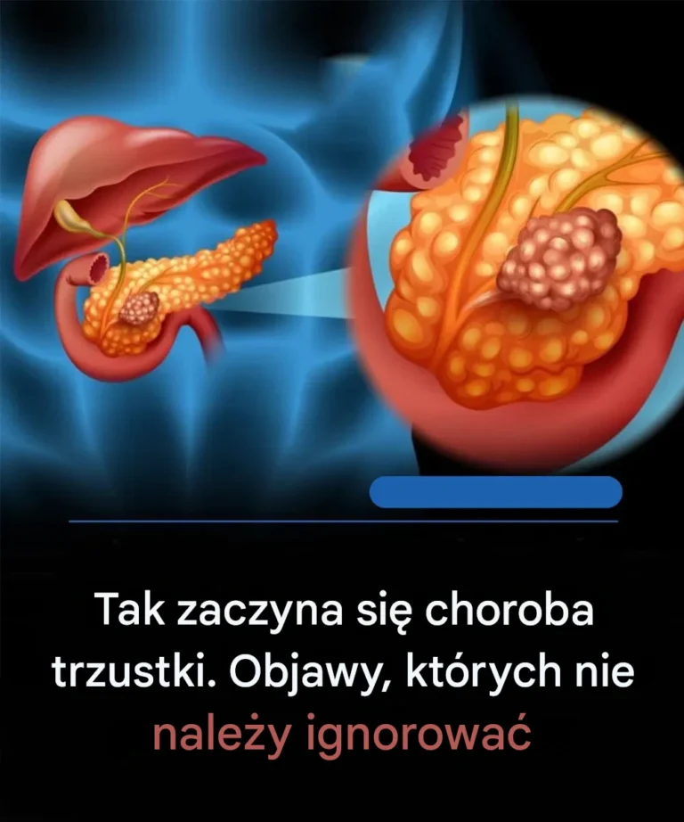 Pancreatic_canc3r_symptoms_you_should_know__and_how_the_disease_develops