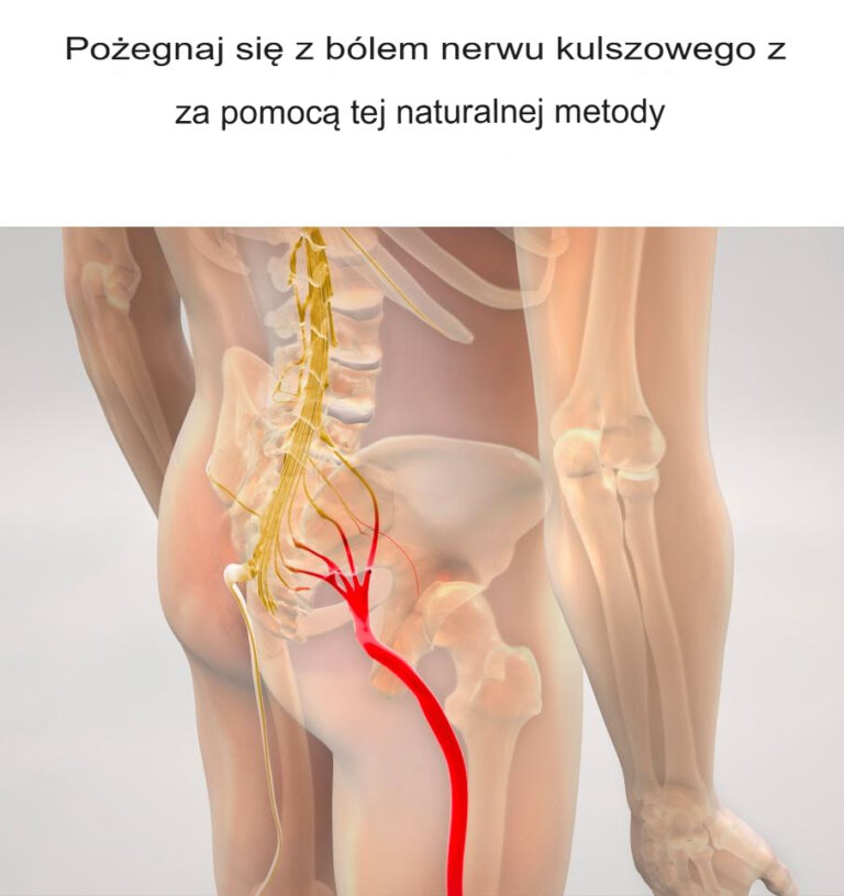 Po_egnaj_b_l_nerwu_kulszowego_dzi_ki_tej_naturalnej_metodzie