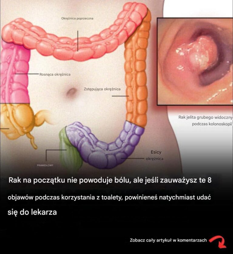 Ponad_40_dziwnych_objaw_w__kt_re_mog__wskazywa__na_diagnoz__raka-1