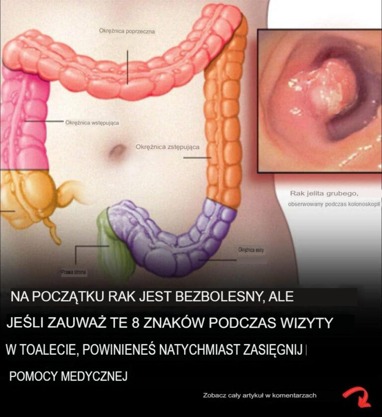 Ponad_40_dziwnych_objaw_w__kt_re_mog__wskazywa__na_diagnoz__raka