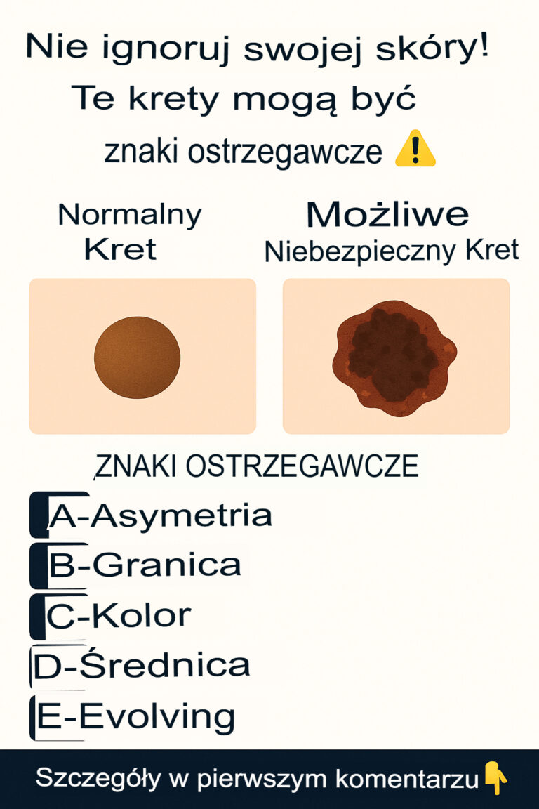 Sprawd__swoj__sk_r___co_mog__Ci_powiedzie__znamiona_i_plamy