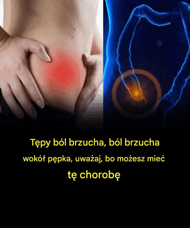 T_py_b_l_brzucha__b_l_brzucha_wok___p_pka__uwa_aj__bo_mo_esz_mie__t__chorob_