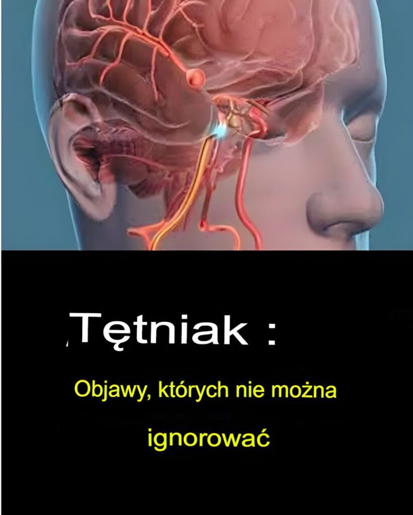 T_tniak_m_zgu___objawy__kt_rych_nie_wolno_ignorowa_ T_tniak_m_zgu___objawy__kt_rych_nie_wolno_ignorowa_