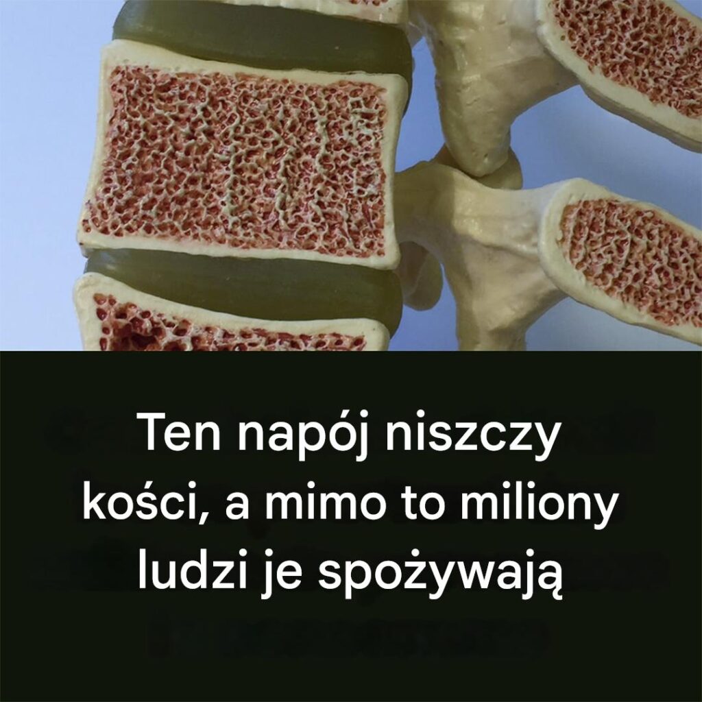 Ten_nap_j_niszczy_ko_ci Ten_nap_j_niszczy_ko_ci