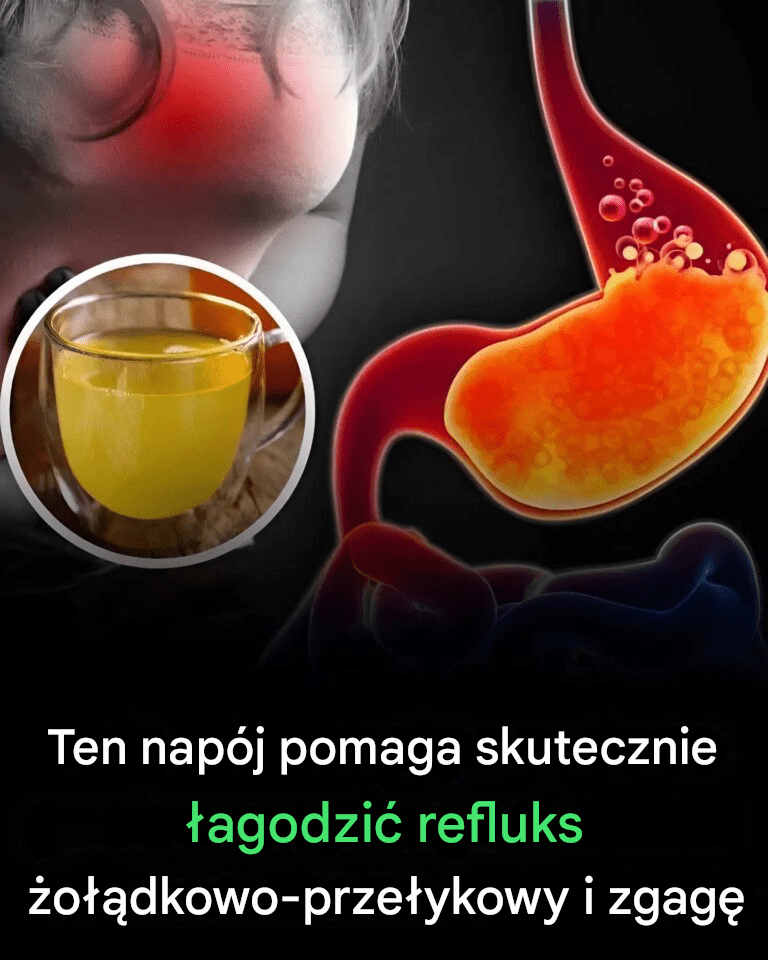 Ten_nap_j_pomaga_skutecznie__agodzi__refluks__o__dkowo_prze_ykowy_i_zgag_ Ten_nap_j_pomaga_skutecznie__agodzi__refluks__o__dkowo_prze_ykowy_i_zgag_