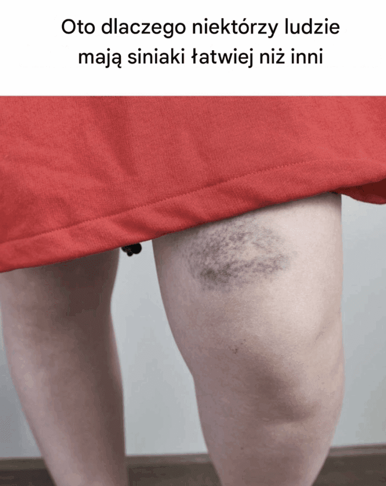To_mi_si__ci_gle_zdarza_i_nigdy_nie_wiedzia_am_dlaczego__Teraz_ju__wiem__Wiedzia_e__o_tym_
