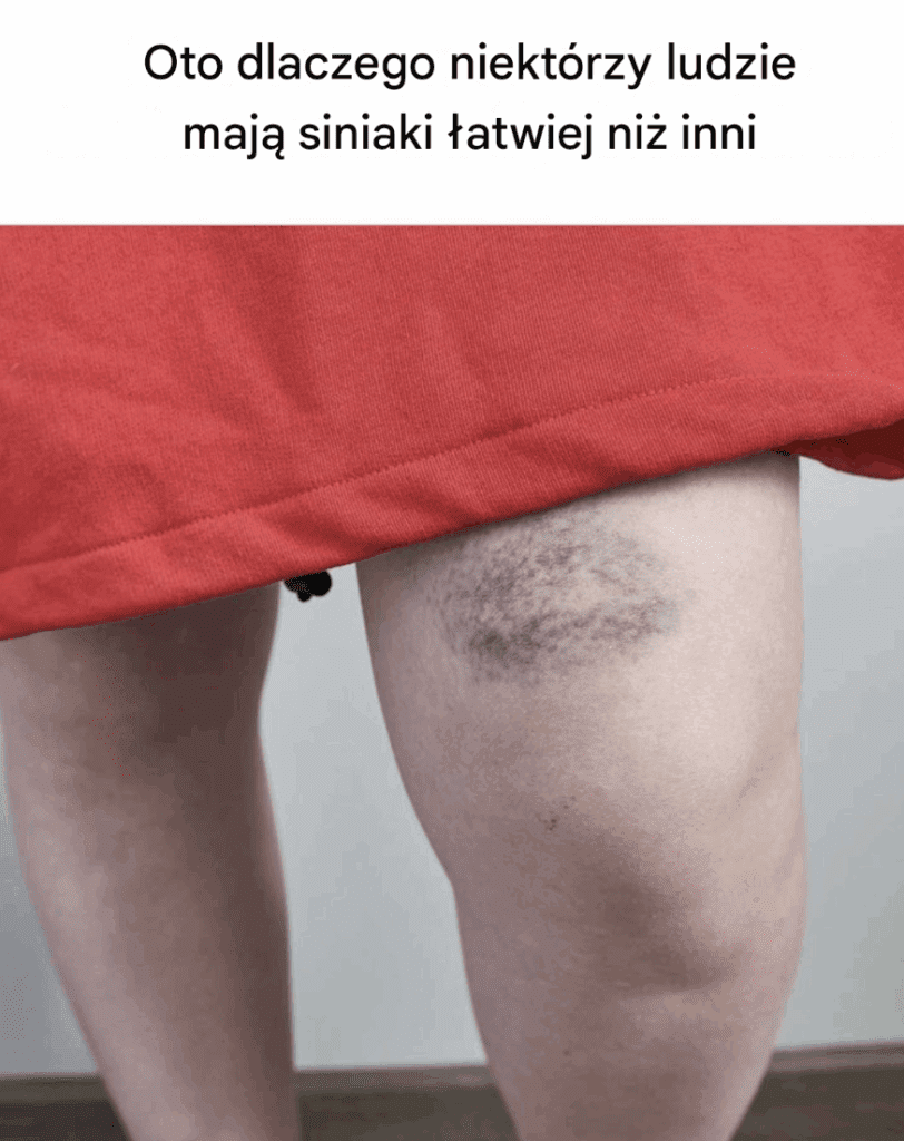 To_mi_si__ci_gle_zdarza_i_nigdy_nie_wiedzia_am_dlaczego__Teraz_ju__wiem__Wiedzia_e__o_tym_ To_mi_si__ci_gle_zdarza_i_nigdy_nie_wiedzia_am_dlaczego__Teraz_ju__wiem__Wiedzia_e__o_tym_