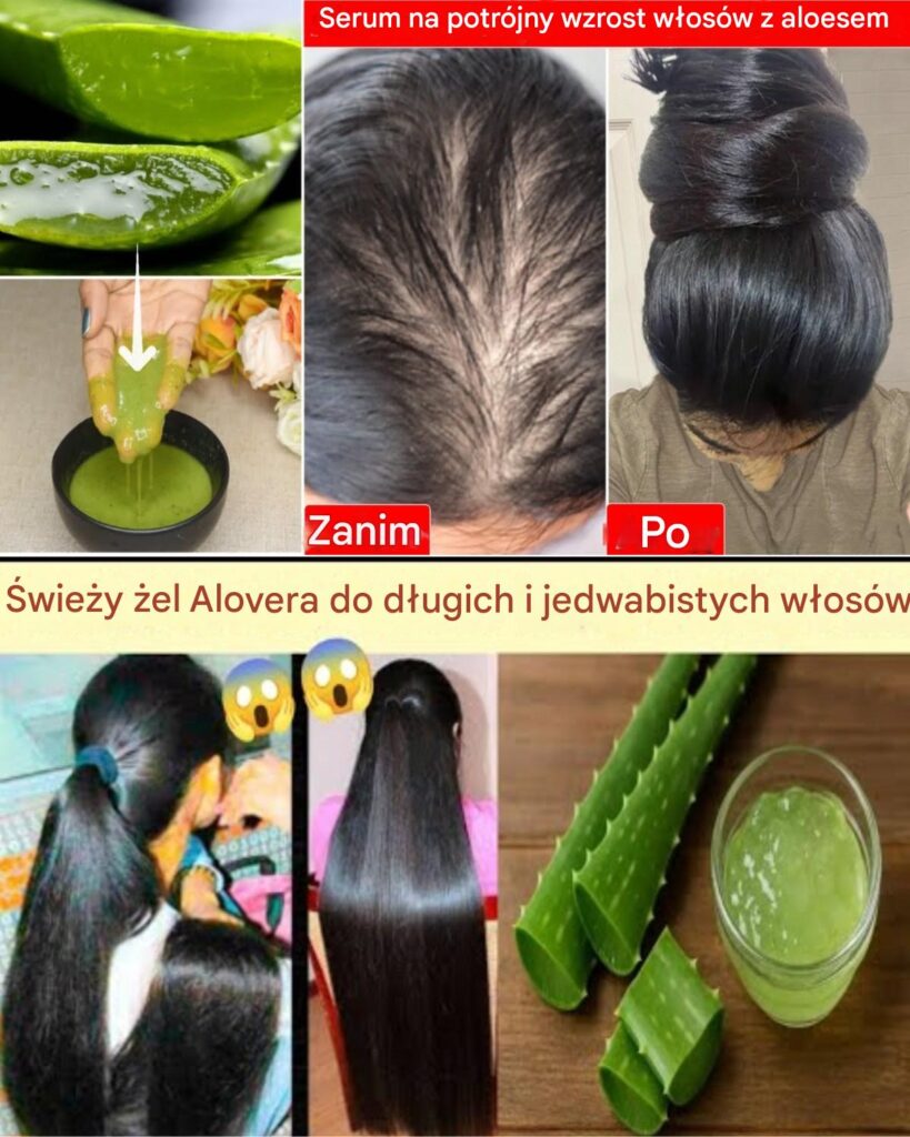 Trik_z_aloesem__Od_przerzedzonych_do_grubszych_w_os_w_w_30_dni Trik_z_aloesem__Od_przerzedzonych_do_grubszych_w_os_w_w_30_dni