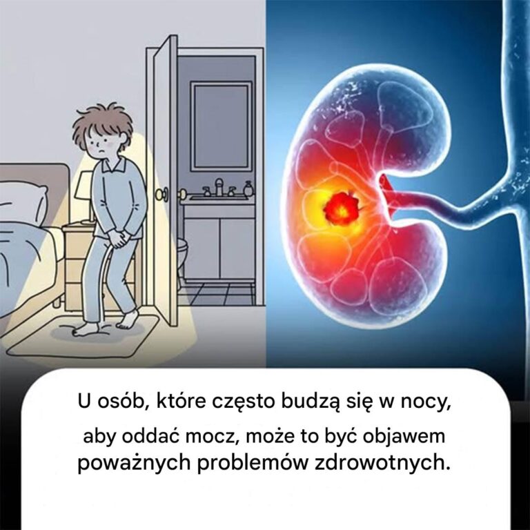 U_os_b__kt_re_budz__si__w_nocy_cz__ciej_ni__2_razy__aby_odda__mocz__mo_e_to_by__objawem_tych_problem_w_zdrowotnych