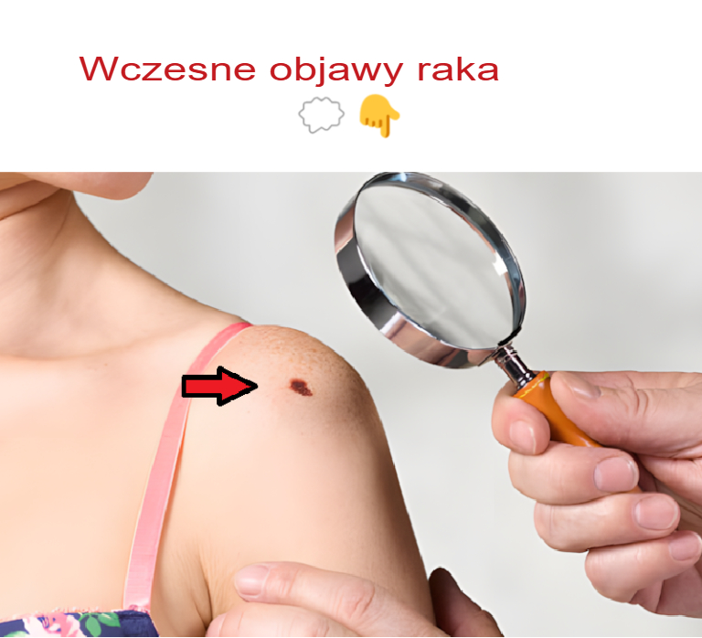 Wczesne_objawy_raka Wczesne_objawy_raka