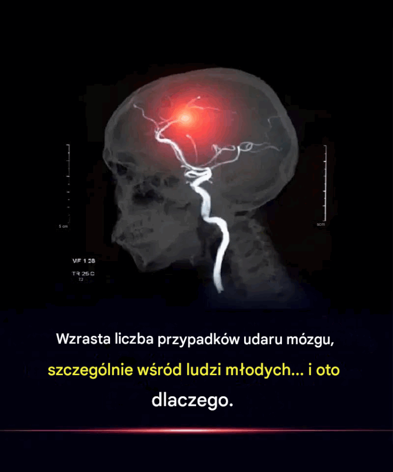Wska_niki_udar_w_m_zgu_rosn___zw_aszcza_w_r_d_m_odych_ludzi__i_oto_dlaczego_