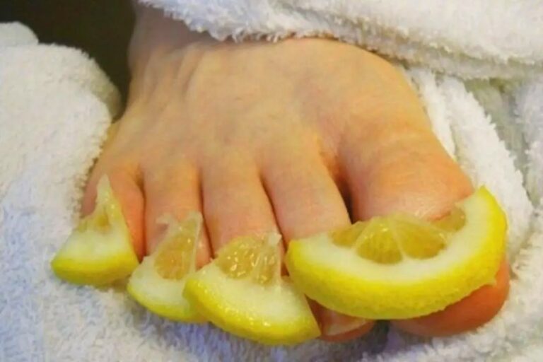 Wyeliminuj_grzybic__paznokci__Skutecznie_lecz_grzybic__paznokci_w_100__naturaln__cytryn__i_sol_