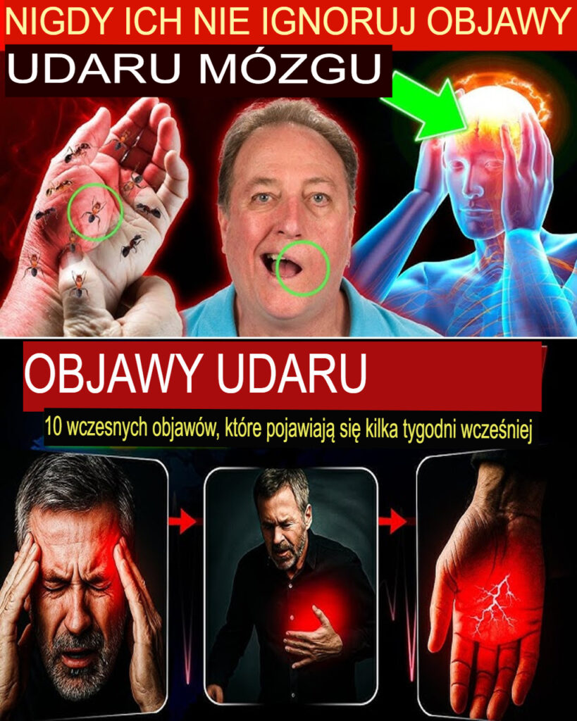 Wykryj_te_10_objaw_w_udaru_m_zgu_tydzie__wcze_niej Wykryj_te_10_objaw_w_udaru_m_zgu_tydzie__wcze_niej