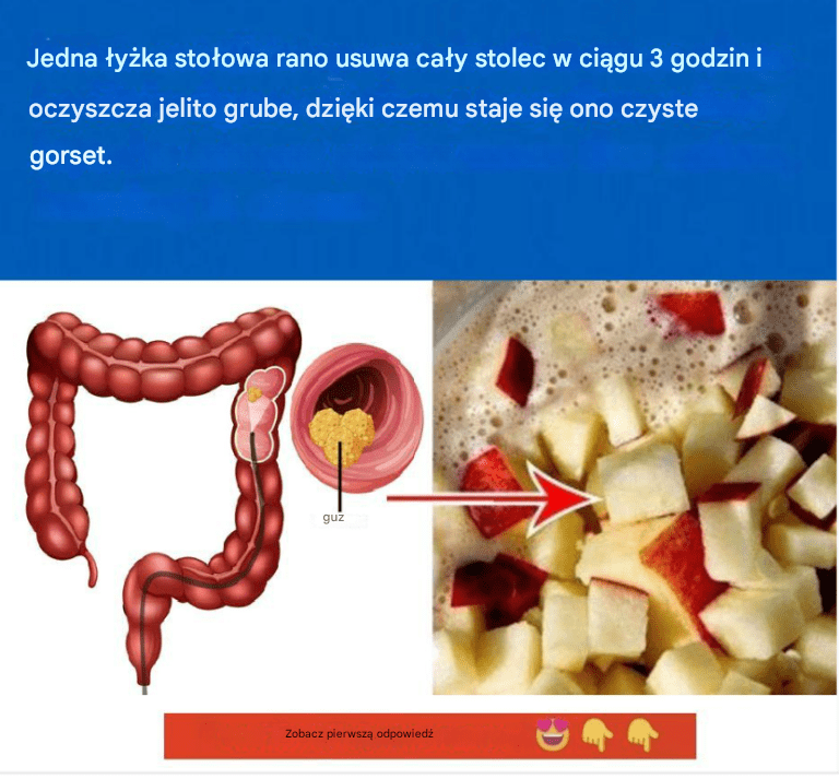 Zaparcia__Tak__istniej__3_naturalne_sposoby__kt_re_mo_na_wykorzysta__w_celu_ochrony_swojej_diety_