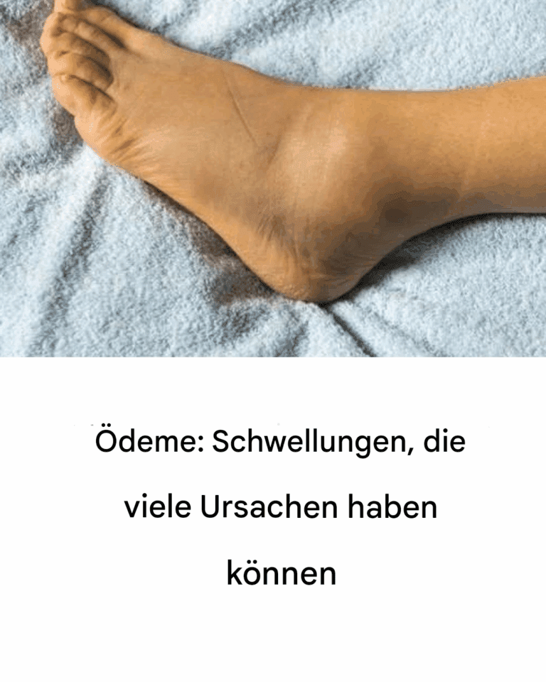 deme__Schwellungen__die_viele_Ursachen_haben_k_nnen