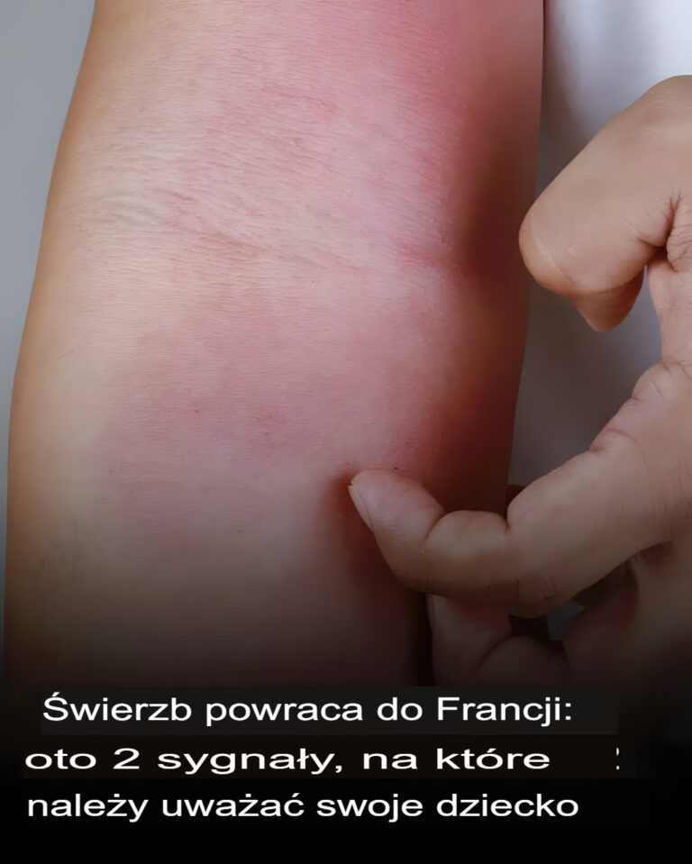 wierzb_powr_ci__do_Francji__oto_2_objawy__na_kt_re_nale_y_zwr_ci__uwag__u_dziecka