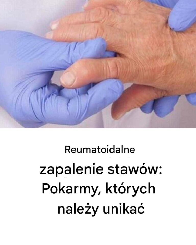 ycie_z_reumatoidalnym_zapaleniem_staw_w__wyzwania__z_kt_rymi_mierzysz_si__ka_dego_dnia