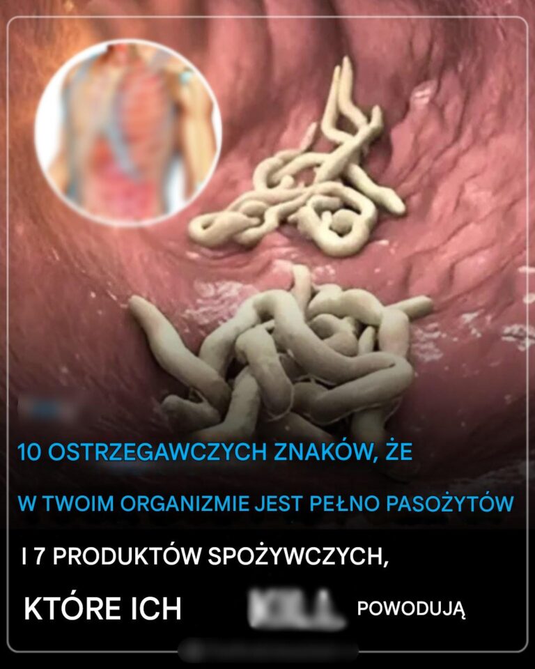 10_ostrzegawczych_znak_w___e_w_Twoim_organizmie_znajduje_si__mn_stwo_paso_yt_w_i_7_produkt_w_spo_ywczych__kt_re_pomog__si__ich_pozby__