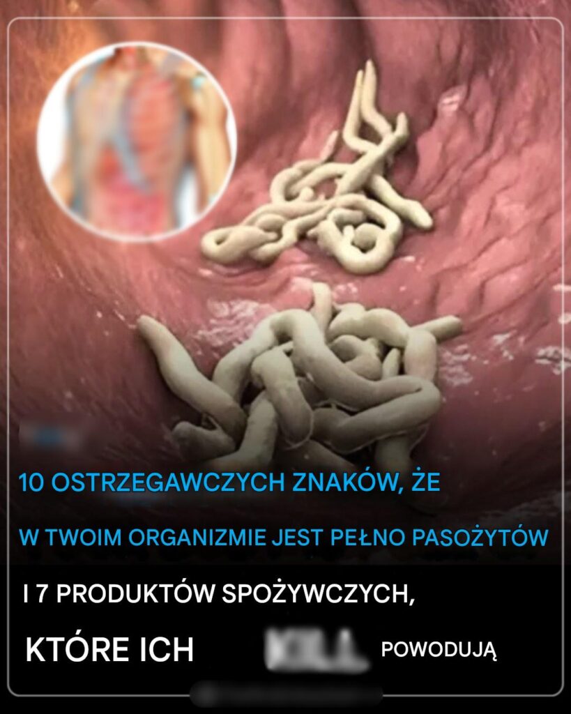 10_ostrzegawczych_znak_w___e_w_Twoim_organizmie_znajduje_si__mn_stwo_paso_yt_w_i_7_produkt_w_spo_ywczych__kt_re_pomog__si__ich_pozby__ 10_ostrzegawczych_znak_w___e_w_Twoim_organizmie_znajduje_si__mn_stwo_paso_yt_w_i_7_produkt_w_spo_ywczych__kt_re_pomog__si__ich_pozby__
