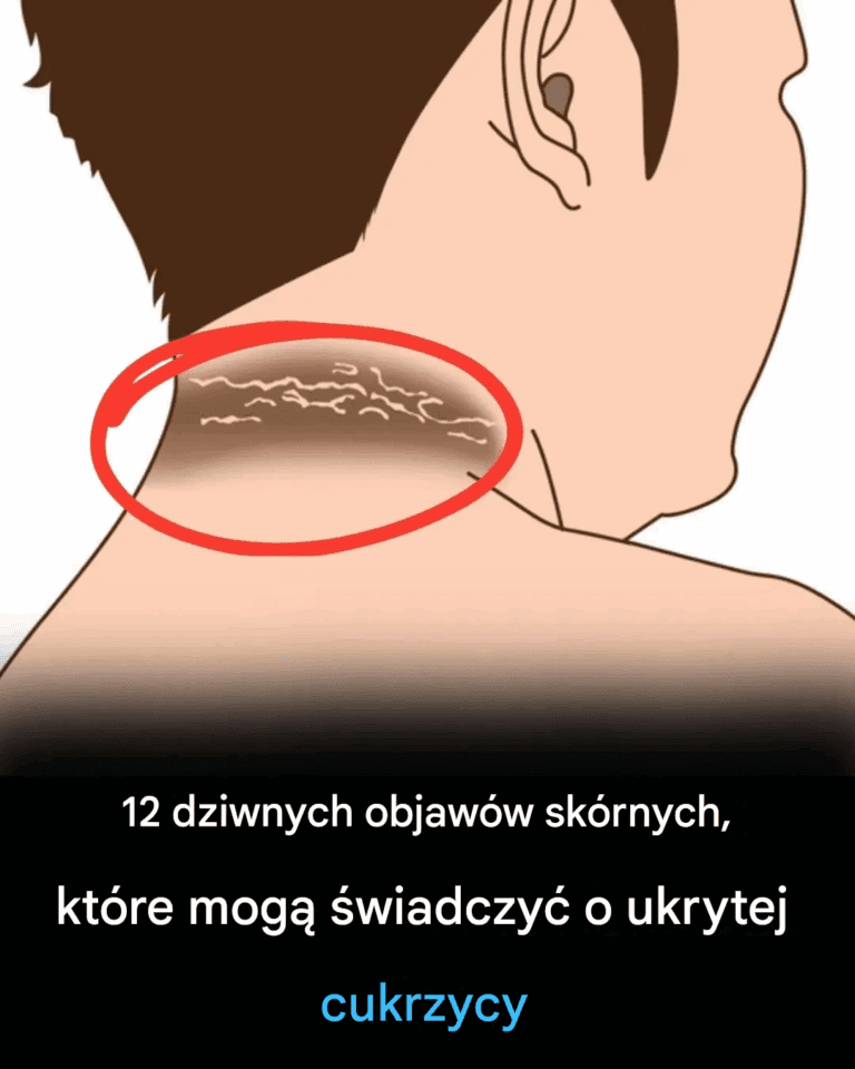 12_Dziwnych_Problem_w_Sk_rnych_Z_Cukrzyc___Kt_re_Musisz_Zna_