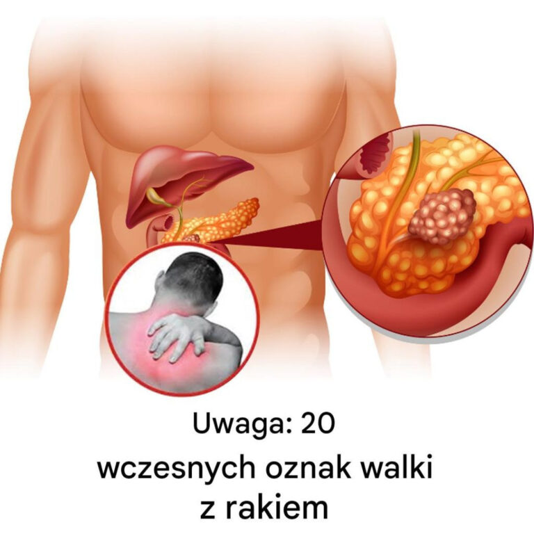 20_wczesnych_oznak___e_Tw_j_organizm_walczy_z_chorob_