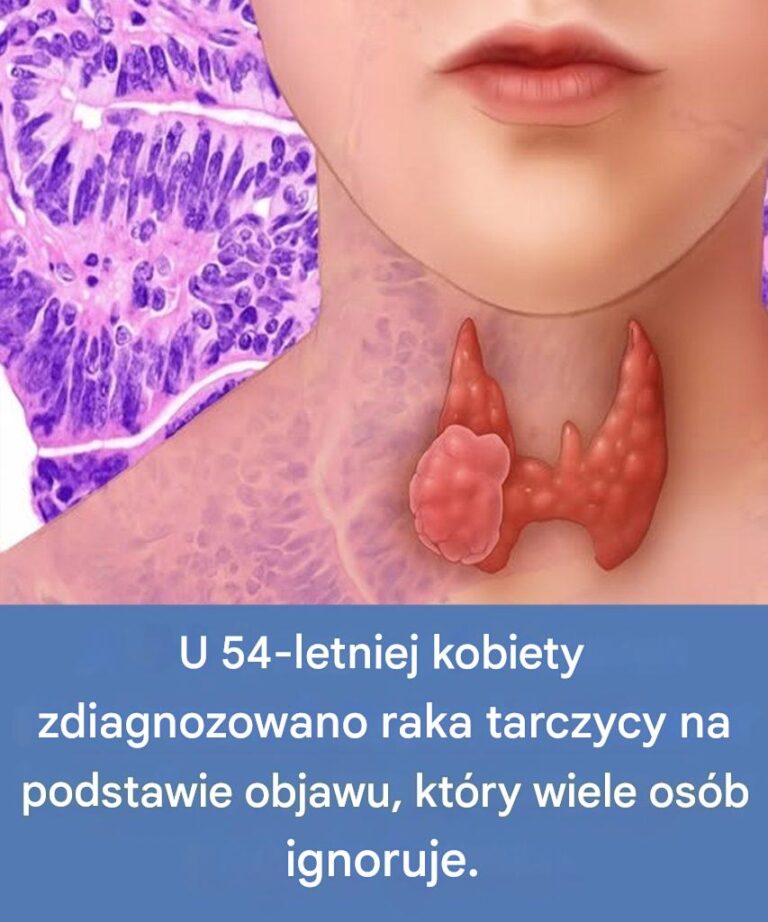 54_letnia_kobieta_dowiedzia_a_si____e_ma_raka_tarczycy__co_jest_objawem__na_kt_ry_cz_sto_nie_zwraca_si__uwagi