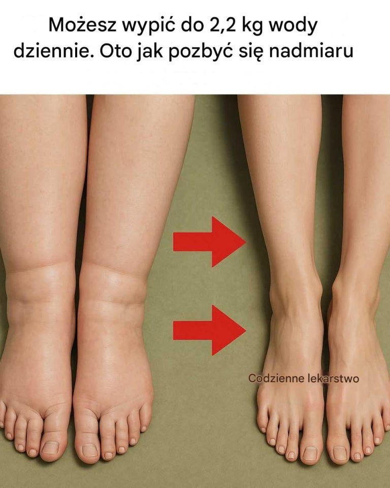 5_prostych_krok_w__dzi_ki_kt_rym_pozb_dziesz_si__nawet_2_kilogram_w_zalegaj_cej_wody 5_prostych_krok_w__dzi_ki_kt_rym_pozb_dziesz_si__nawet_2_kilogram_w_zalegaj_cej_wody