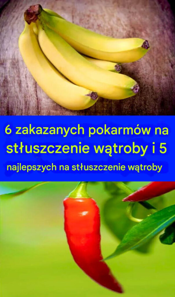 6_produkt_w_spo_ywczych__kt_rych_nale_y_unika__w_przypadku_st_uszczenia_w_troby_i_5_najlepszych_produkt_w_na_st_uszczenie_w_troby-1