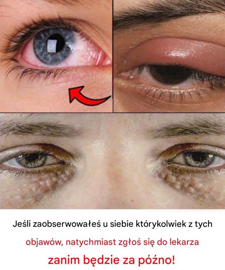 8_rzeczy__kt_re_Twoje_oczy_m_wi__o_Twoim_zdrowiu__Je_li_masz_kt_rykolwiek_z_tych_objaw_w__natychmiast_udaj_si__do_lekarza_