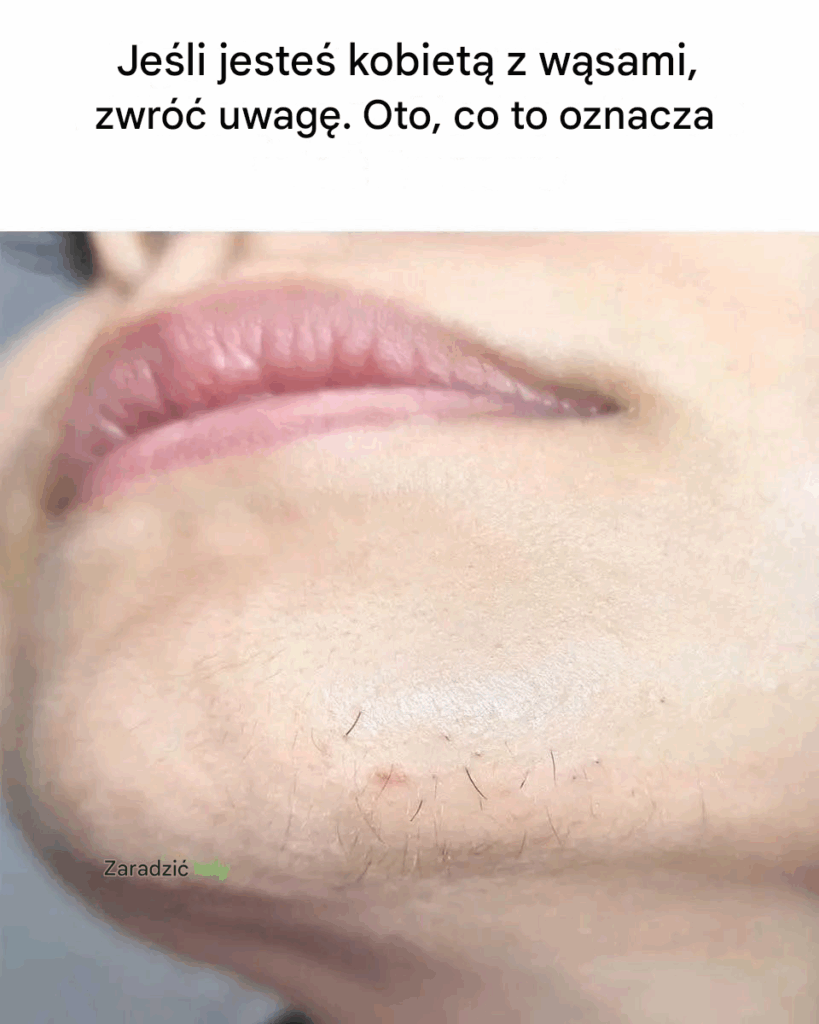 Co_Chin_Whiskers_mog__powiedzie__Ci_o_twoim_zdrowiu Co_Chin_Whiskers_mog__powiedzie__Ci_o_twoim_zdrowiu