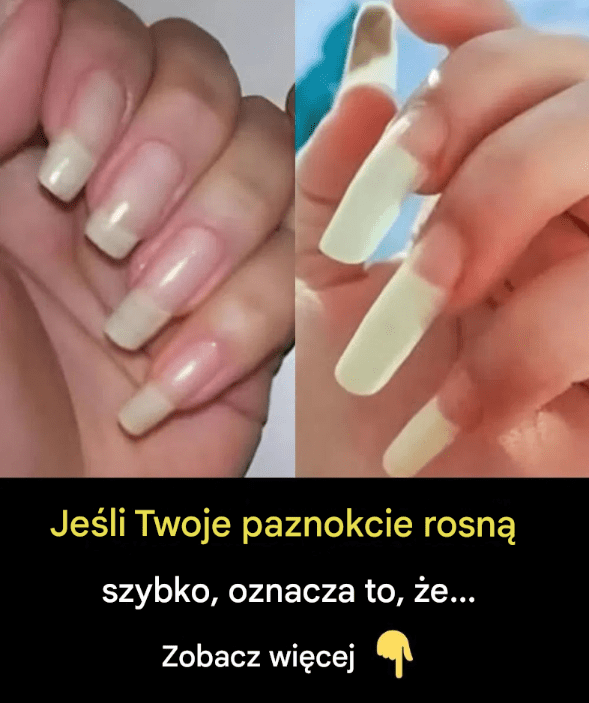 Co_tak_naprawd__oznacza_szybki_wzrost_paznokci_ Co_tak_naprawd__oznacza_szybki_wzrost_paznokci_