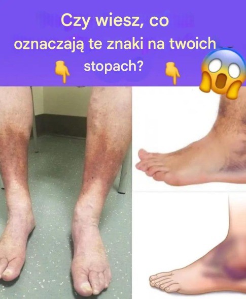 Czy_wiesz_co_oznaczaj__te_znaki_na_twoich_stopach___pe_na_metoda____ Czy_wiesz_co_oznaczaj__te_znaki_na_twoich_stopach___pe_na_metoda____
