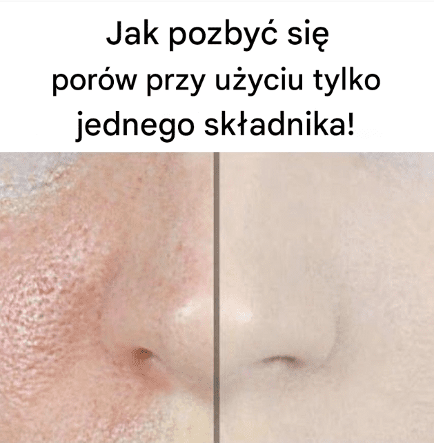 Jak_pozby__si__por_w_za_pomoc__tylko_jednego_sk_adnika___link_w_komentarzach_ Jak_pozby__si__por_w_za_pomoc__tylko_jednego_sk_adnika___link_w_komentarzach_