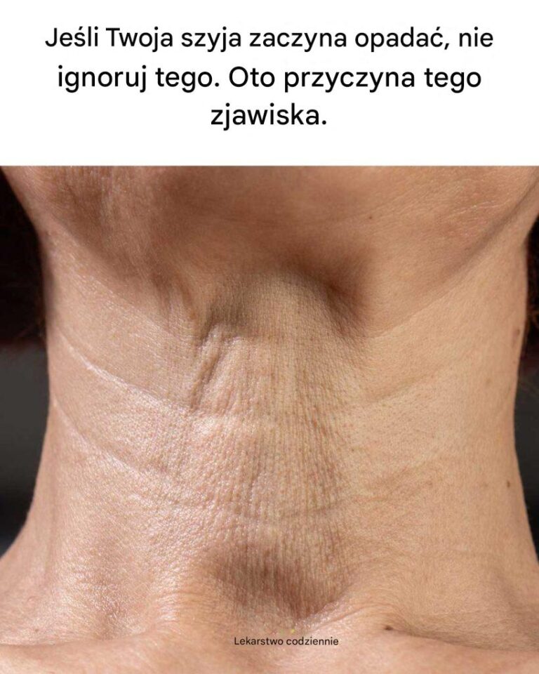 Je_li_Twoja_szyja_zaczyna_zwisa___nie_ignoruj___tego__Oto_dlaczego_tak_si__dzieje_