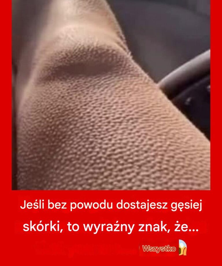 Je_li_bez_powodu_dostajesz_g_siej_sk_rki__to_wyra_ny_znak___e__8230_