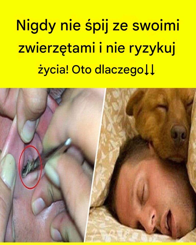 Nie__pij_ze_swoimi_zwierz_tami__nie_ryzykuj__yciem__oto_dlaczego