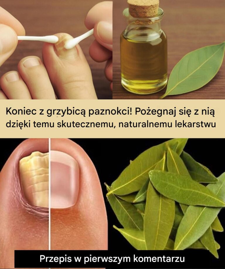 Po_egnaj_si__z_infekcjami_grzybicznymi_dzi_ki_temu_naturalnemu_lekarstwu