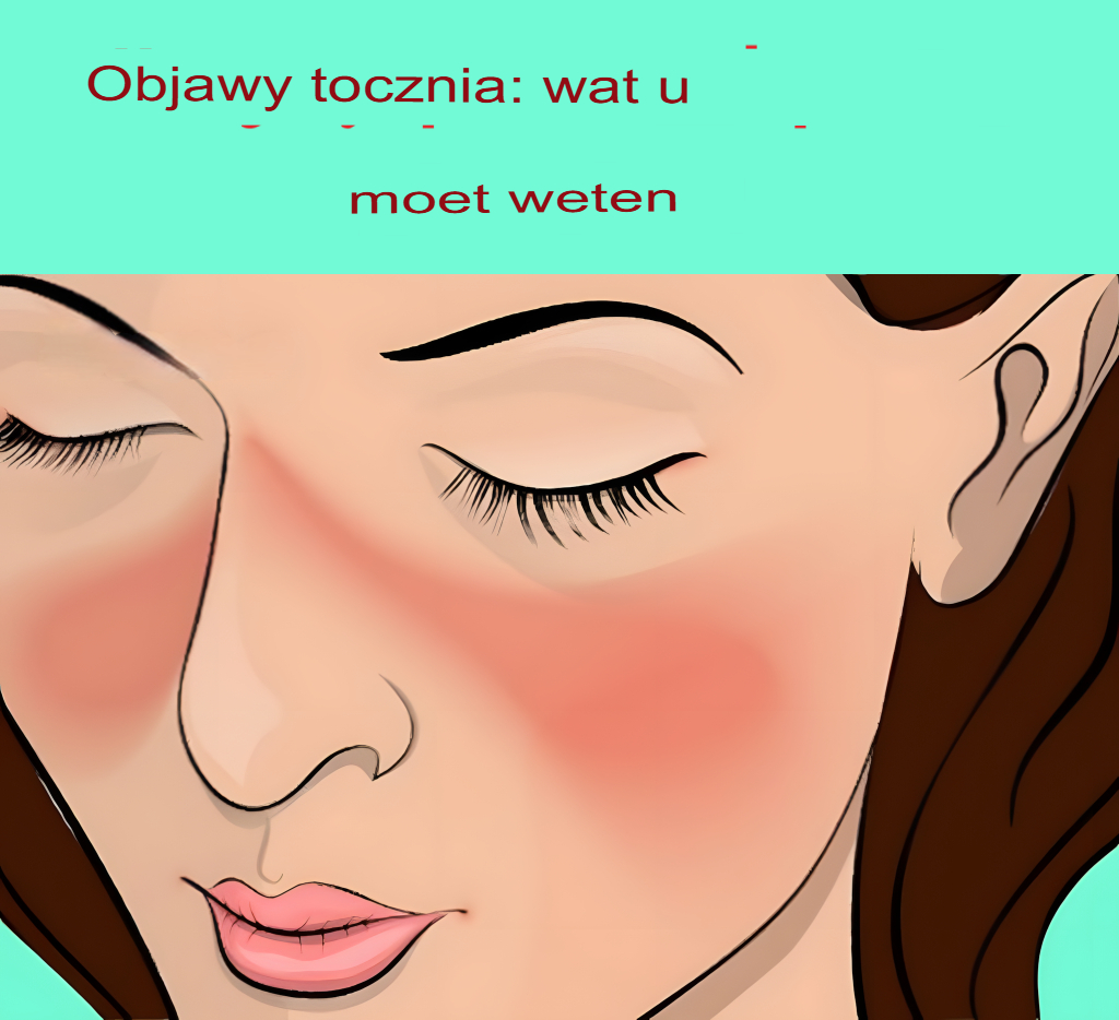 Wczesne_objawy_tocznia__co_musisz_wiedzie_ Wczesne_objawy_tocznia__co_musisz_wiedzie_