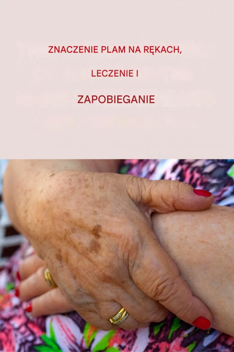 Znaczenie_plam_na_d_oniach___oraz_proste_sposoby_na_ich_naturalne_leczenie_i_zapobieganie