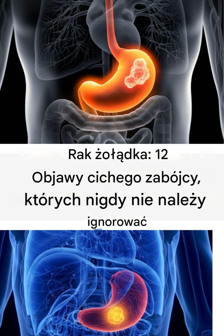 Zwr___uwag__na_te_12_dyskretnych_objaw_w_raka__o__dka