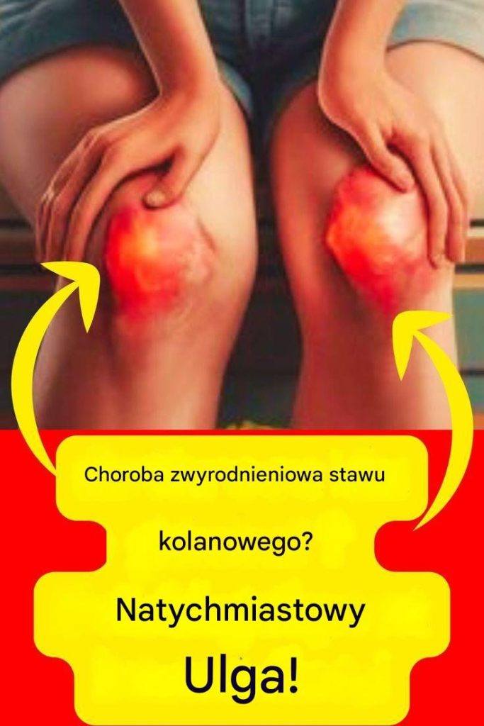 agodne_odci__enie_kolan__10_wskaz_wek_sprawdzonych_przez_ekspert_w_ds__zdrowia agodne_odci__enie_kolan__10_wskaz_wek_sprawdzonych_przez_ekspert_w_ds__zdrowia