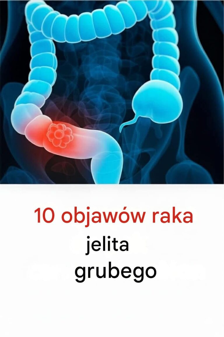 10_objaw_w_raka_jelita_grubego