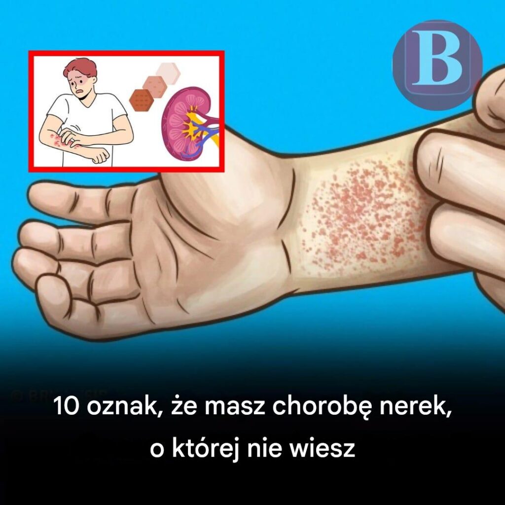 10_sposob_w__w_jakie_Tw_j_organizm_ostrzega_Ci__przed_chorob__nerek__ale_Ty_tego_nie_zauwa_asz_ 10_sposob_w__w_jakie_Tw_j_organizm_ostrzega_Ci__przed_chorob__nerek__ale_Ty_tego_nie_zauwa_asz_