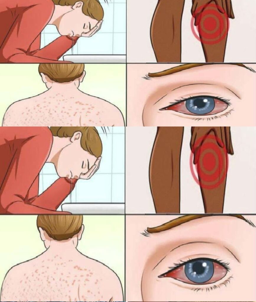 17_oznak_choroby_ple_niowej__i_jak_sprawdzi___czy_jeste__na_ni__nara_ony_ 17_oznak_choroby_ple_niowej__i_jak_sprawdzi___czy_jeste__na_ni__nara_ony_