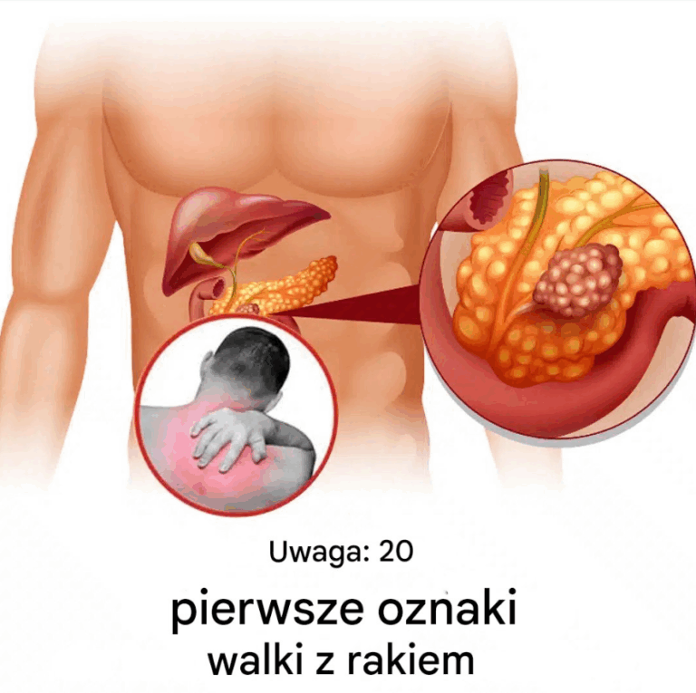 20_wczesnych_sygna__w_ostrzegawczych__je_li_Tw_j_organizm_walczy_z_malati_