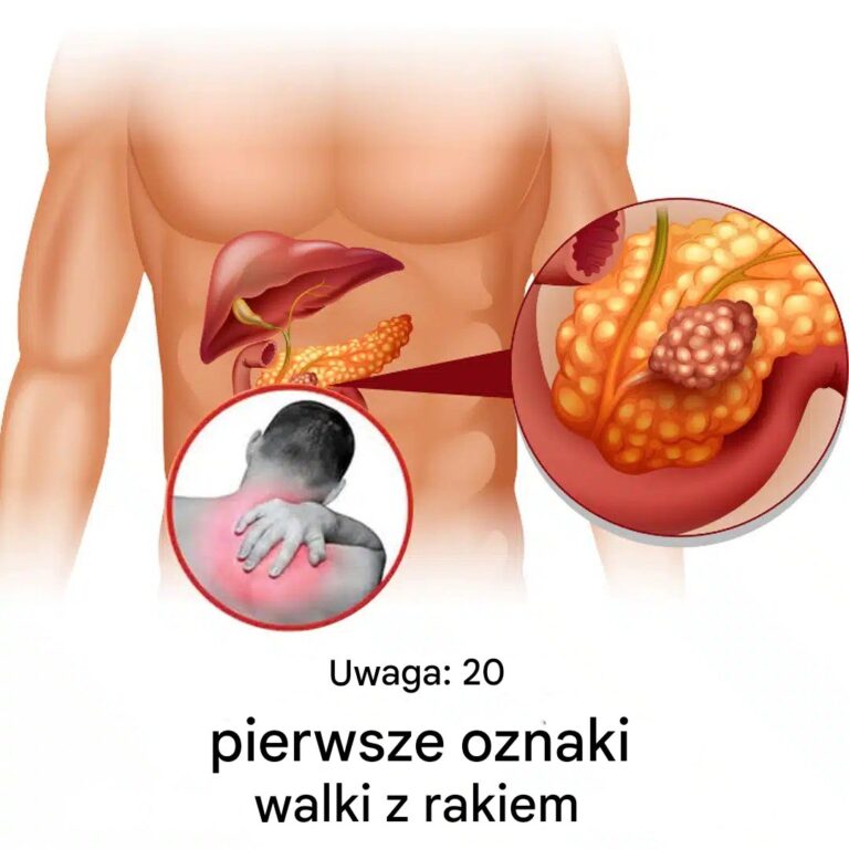 20_wczesnych_sygna__w_ostrzegawczych__je_li_Tw_j_organizm_walczy_z_malati_